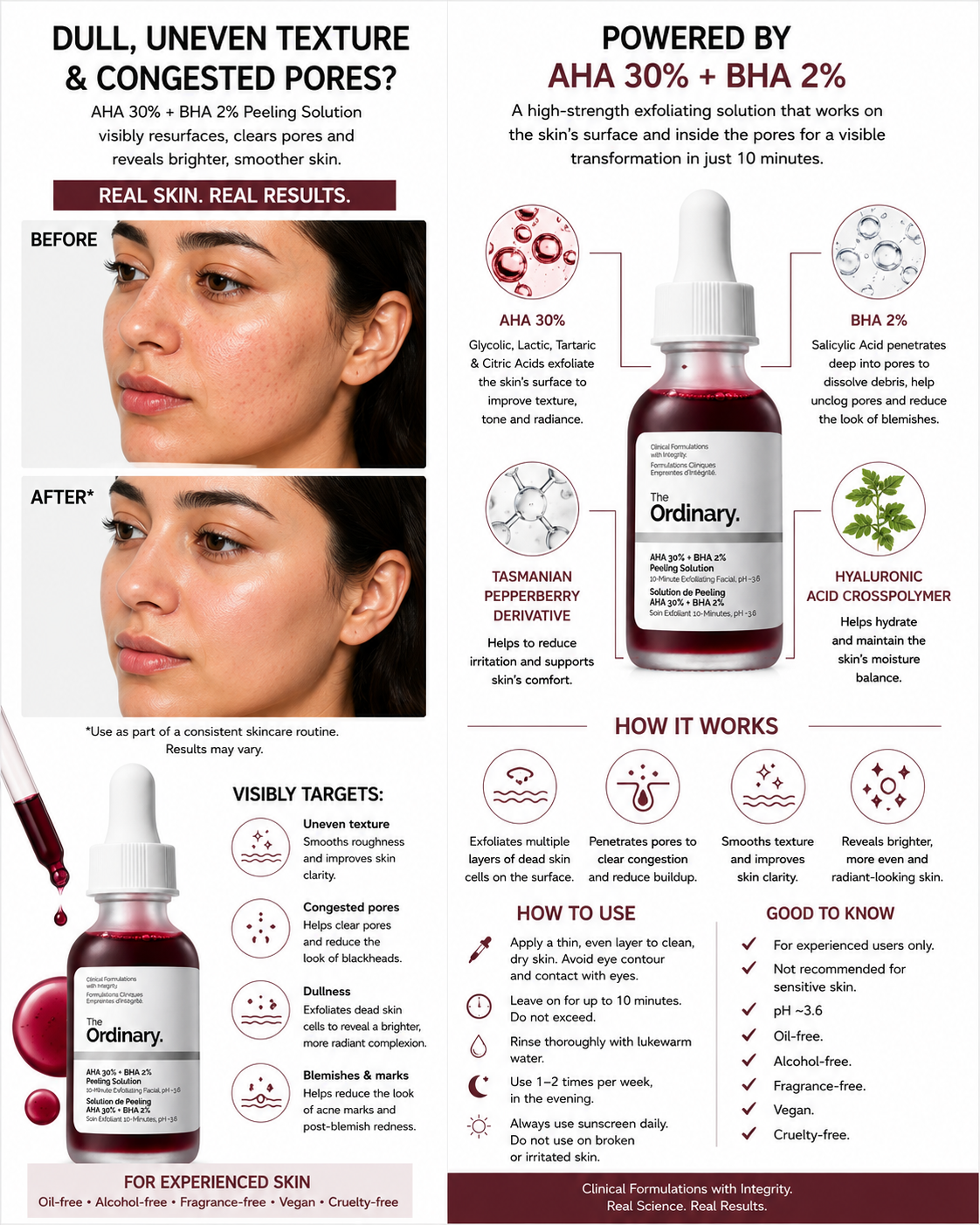 The Ordinary AHA 30% + BHA 2% Peeling Solution (30ml) – Chemical Exfoliant Facial Mask