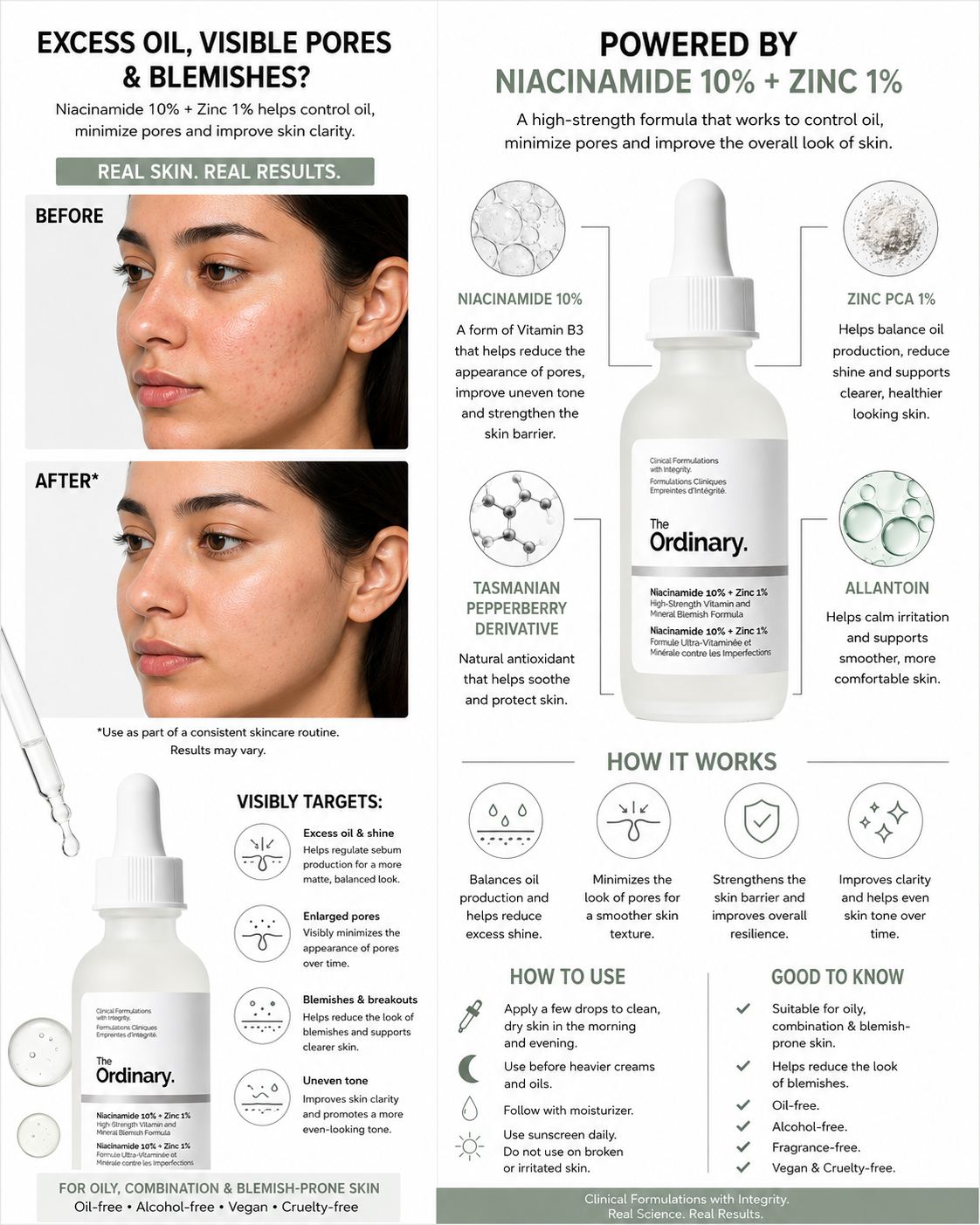The Ordinary Niacinamide 10% + Zinc 1% Serum 30ml - Oil Control Pore Minimizing Face Serum