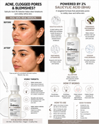 The Ordinary Salicylic Acid 2% Solution (30ml) – BHA Acne & Pore Treatment Serum