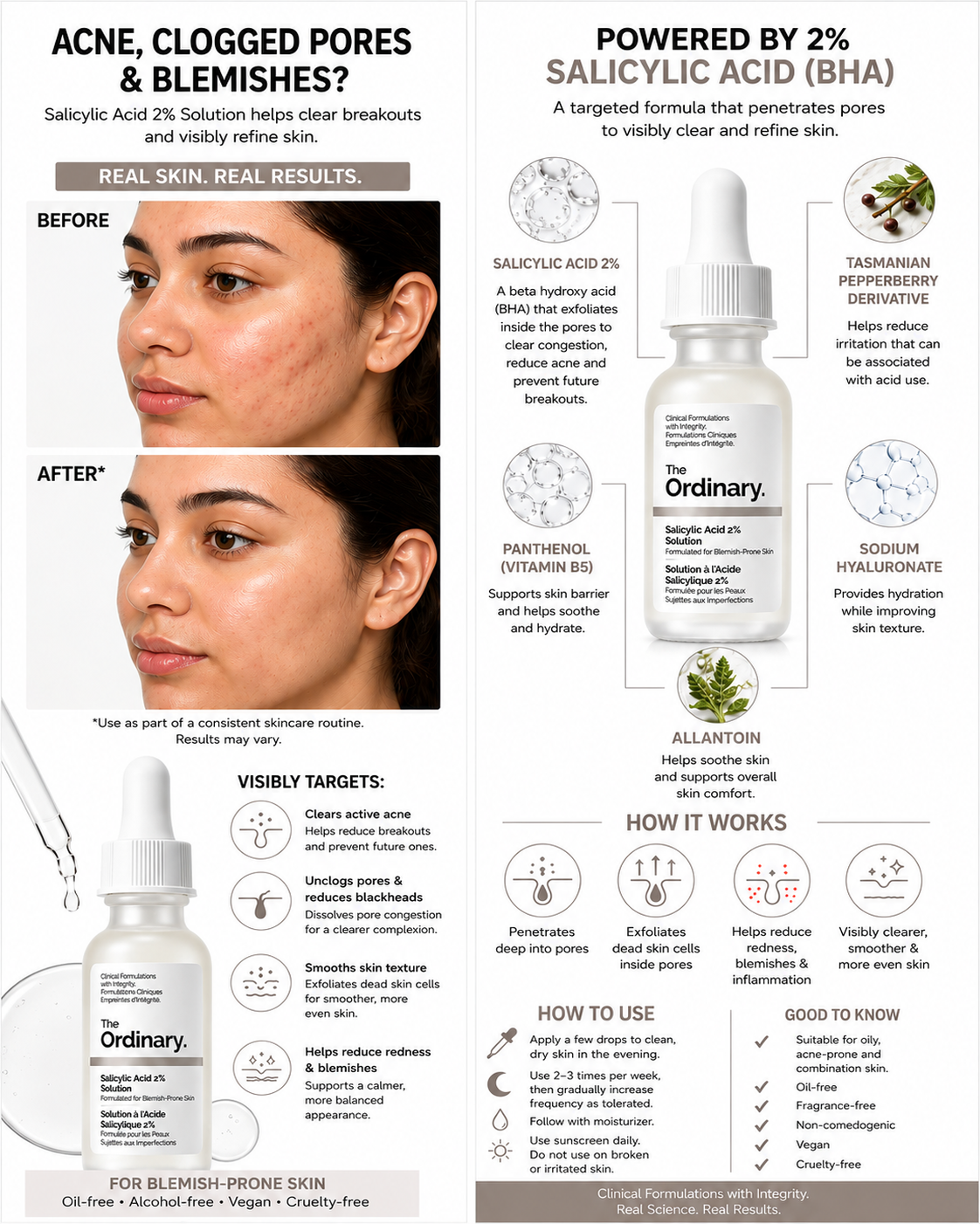 The Ordinary Salicylic Acid 2% Solution (30ml) – BHA Acne & Pore Treatment Serum
